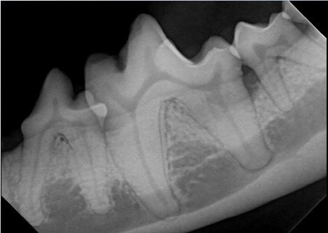 Dental Radiograph